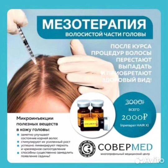 Мезотерапия волосистой части головы