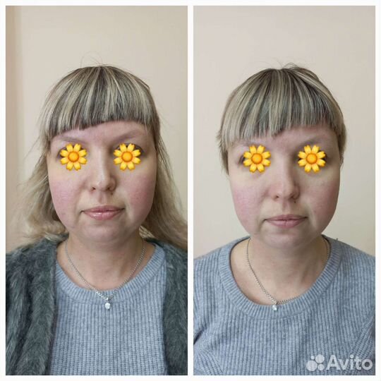 Скульптурный массаж лица