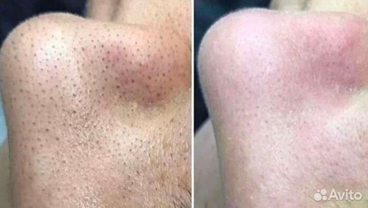 Косметология Массаж