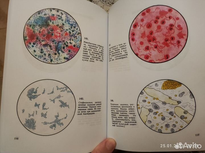 Атлас микроскопии осадков мочи
