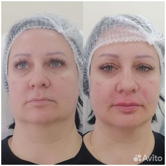 Услуги косметолога