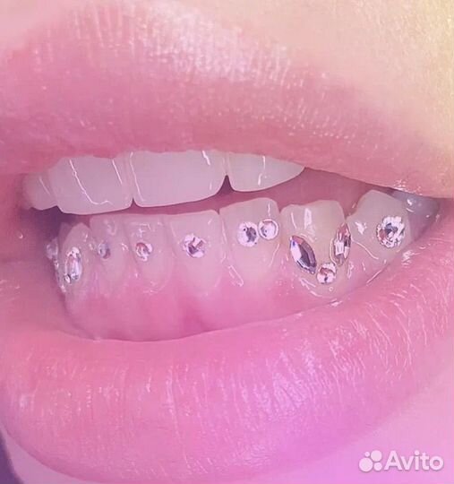 Стразы на зубки(без сверления)безопасный метод