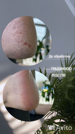 Подология/педикюр