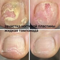 Педикюр любой сложности, Москва