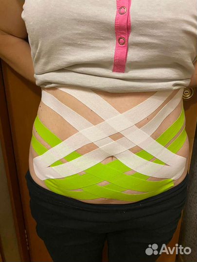 Эстетическое тейпирование