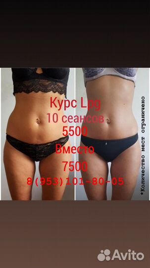 LPG массаж в Новороссийске