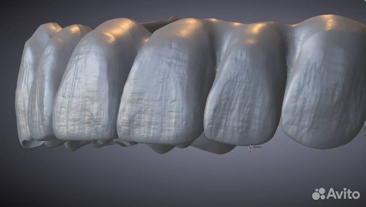 Blender for dental (B4D) iBar (балки) и все модули