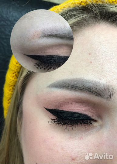 Удаление тату и татуажа