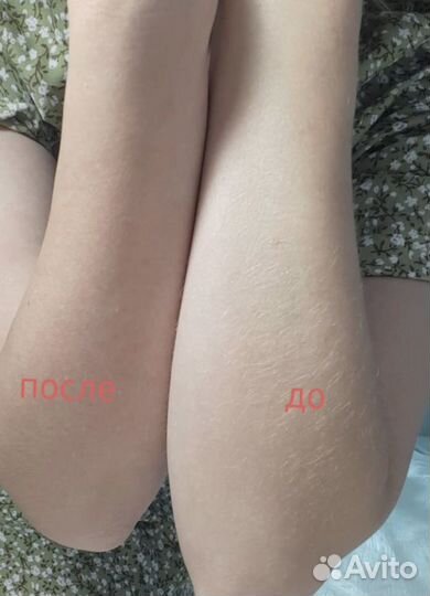 Шугаринг