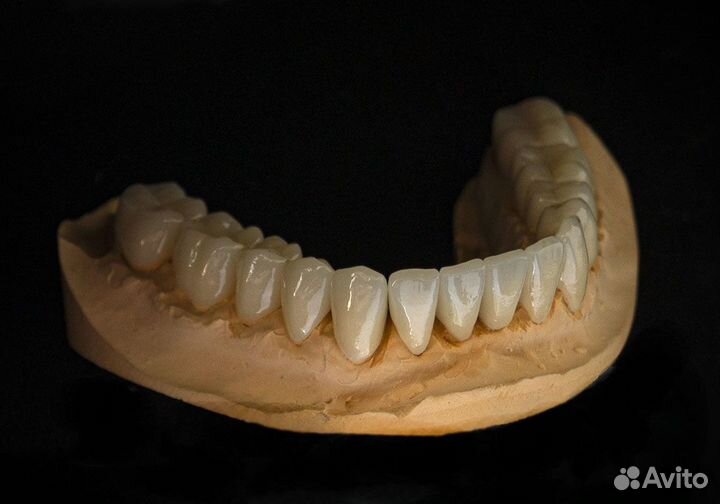 Все виды зуботехнических работ - четко и в срок