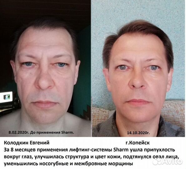 Нужны модели для лифтинг системы шарм. бесплатно