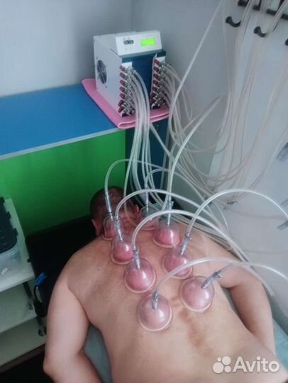 Баночный массаж