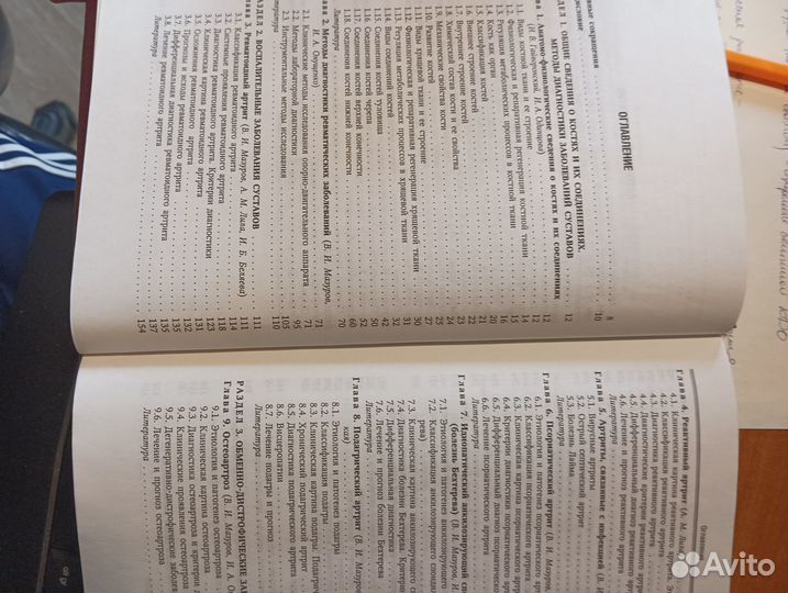 Болезни суставов