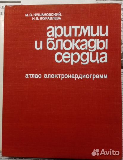 Атлас электрокардиограмм