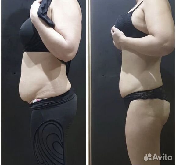 Вытяжка позвоночника, массаж