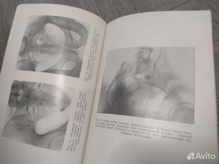 Книга по медицине. Камни почек и мочеточников