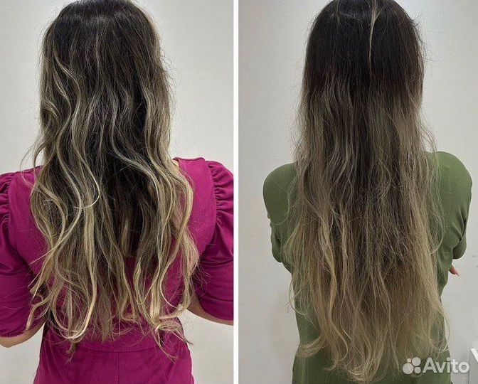 Лечение выпадения волос