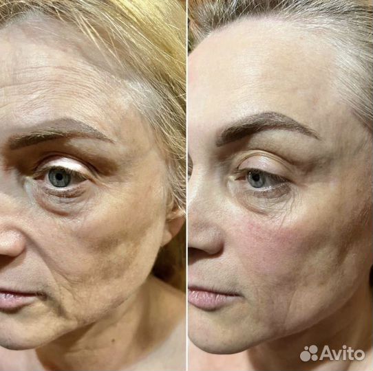 Массаж лица