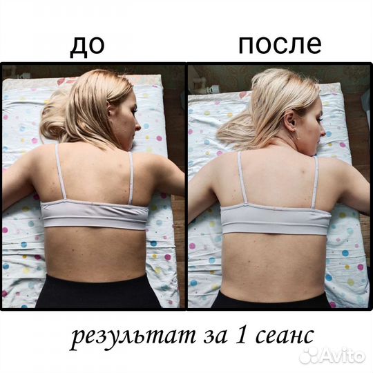 Массаж. Мягкие мануальные техники