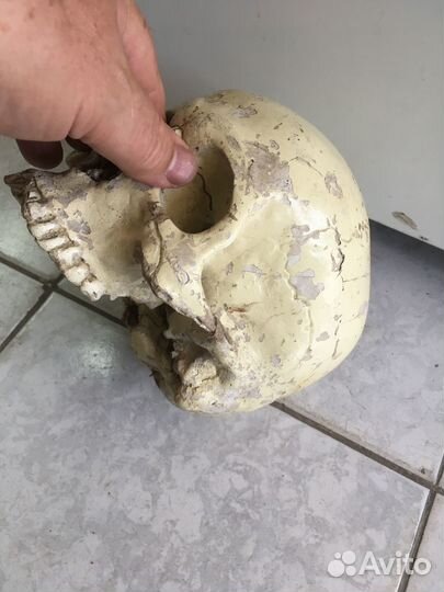 Довоенный медицинский череп