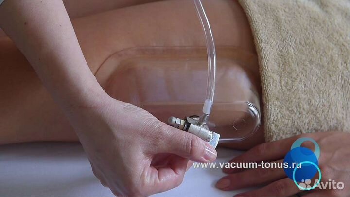 Вакуумно баночный аппарат