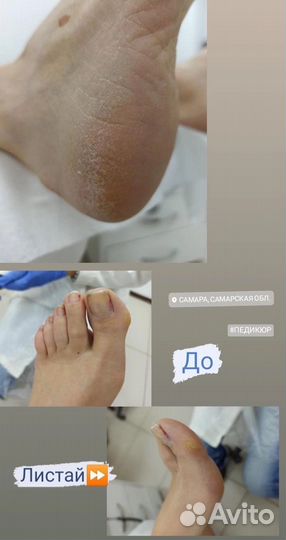 Педикюр с покрытием лаком