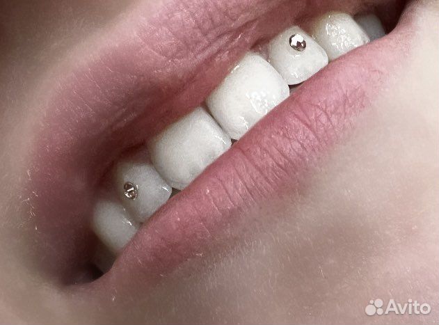 Установка скайсов