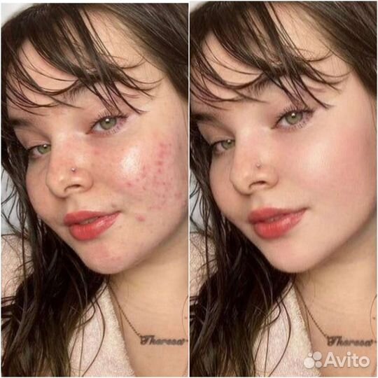 Ретушь и обработка фотографий фотошоп