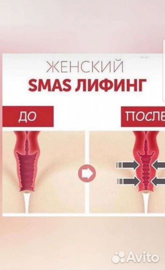 Интимное омоложение, подтяжка, интимная пластика