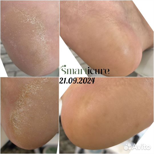 Мужской педикюр и маникюр