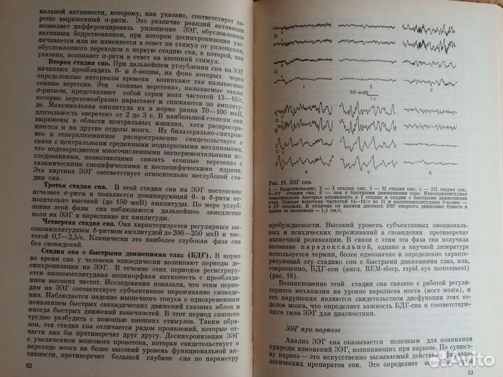 Функциональная диагностика нервных болезней 1982