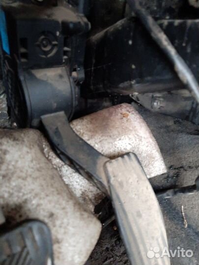 Электронная педаль.педальный узел Лада гранта кали