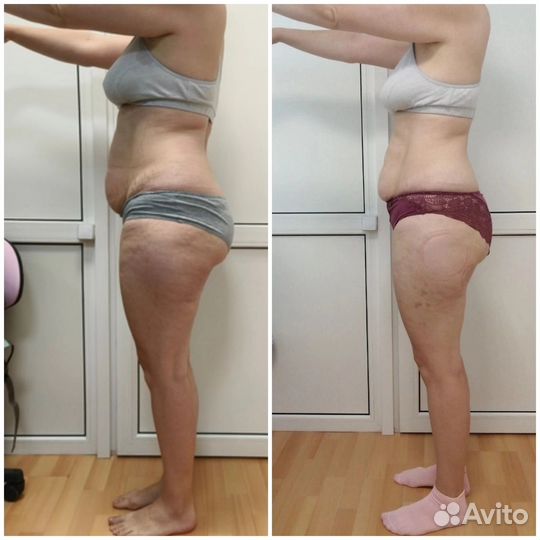 Требуются модели по коррекции фигуры и похудению