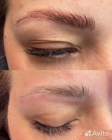 Удаление перманента/ Перманентный макияж