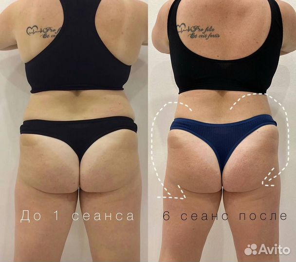 Моделирование фигуры, наращивание ресниц, шугаринг