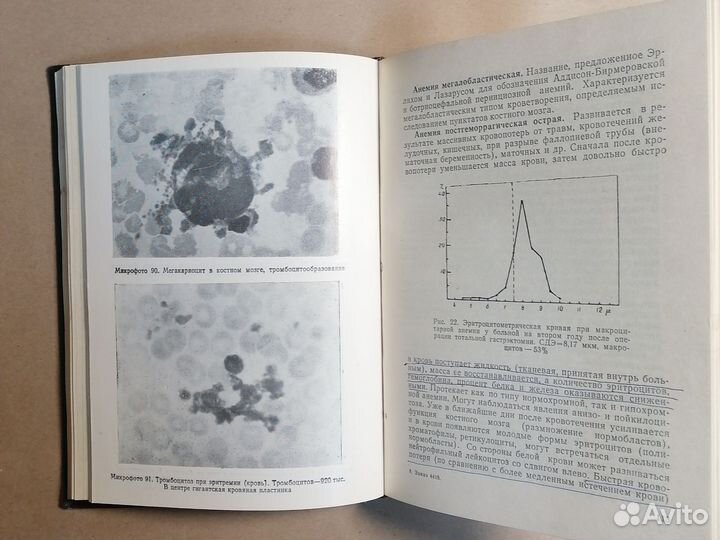 Справочник по гематологии. С атласом микрофотограм