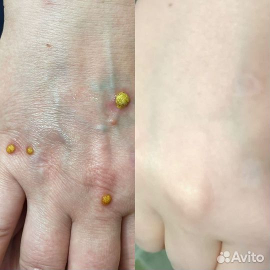 Услуги Подолога 49-39-29