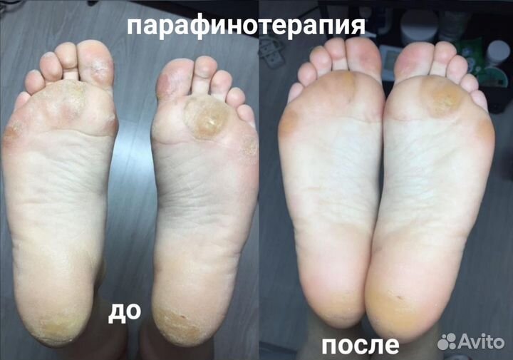 Депиляция, шугаринг, воск метро Просвещения Озерки