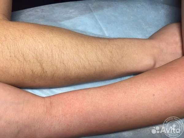 Мастер шугаринга и депиляции