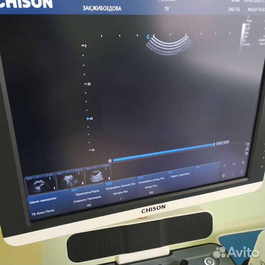 Узи аппарат Qbit8 Chison