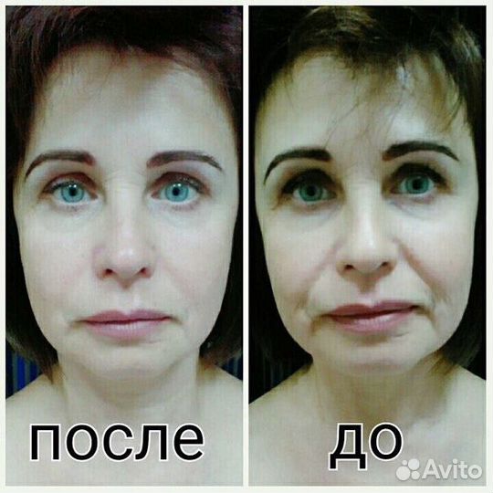 Витапластика и массаж