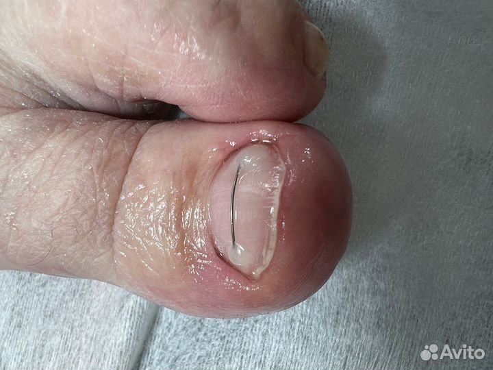 Педикюр на дому