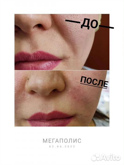 Услуги косметолога
