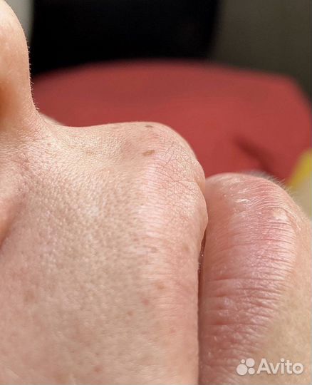 Шугаринг,воск, эпиляция