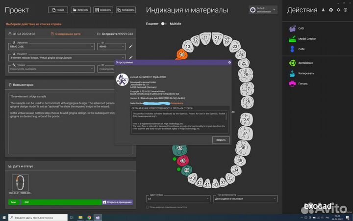 Exocad v.3.1 Rijeka bulld 8200