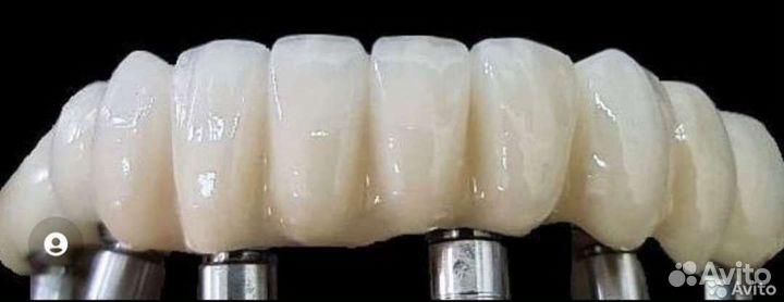 Зубной техник керамист