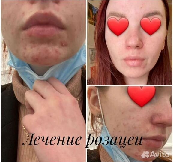 Услуги косметолога