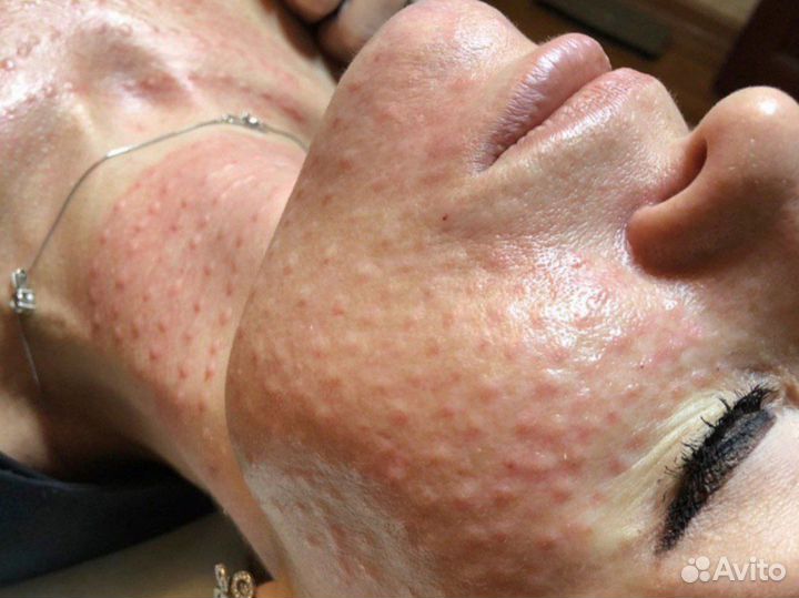 Услуги косметолога