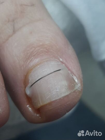 Маникюр Педикюр гель лак Подология