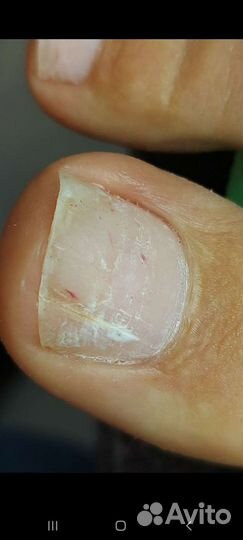 Подология, медицинский педикюр